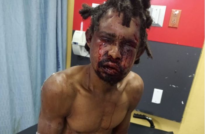 Hombre tortura brutalmente y viola con un palo a un vecino en Cancino II